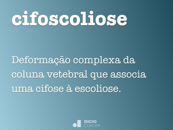 cifoscoliose