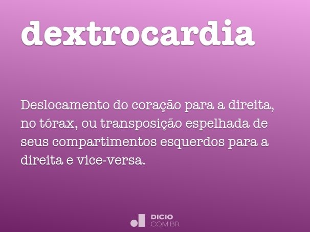 dextrocardia
