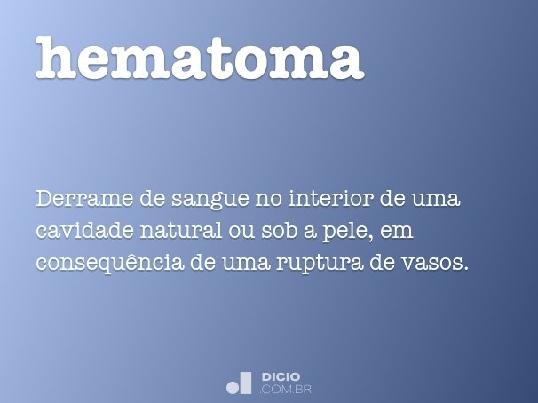 hematoma