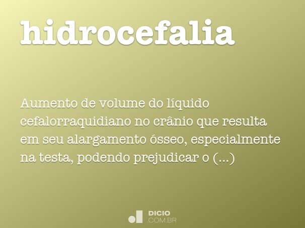 hidrocefalia