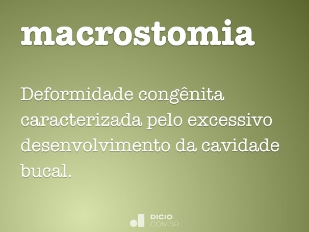macrostomia