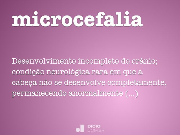 microcefalia