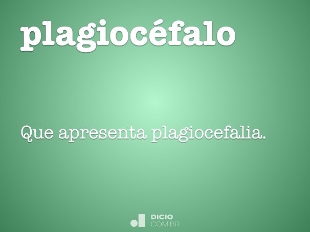 plagiocéfalo