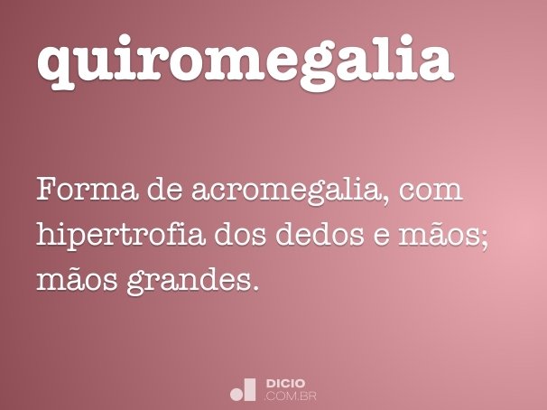 quiromegalia